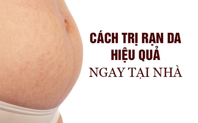 Cách trị rạn da