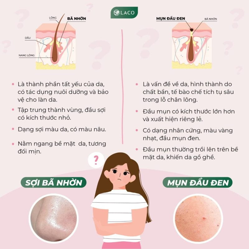 Sợi bã nhờn và mụn đầu đen khác nhau như thế nào?